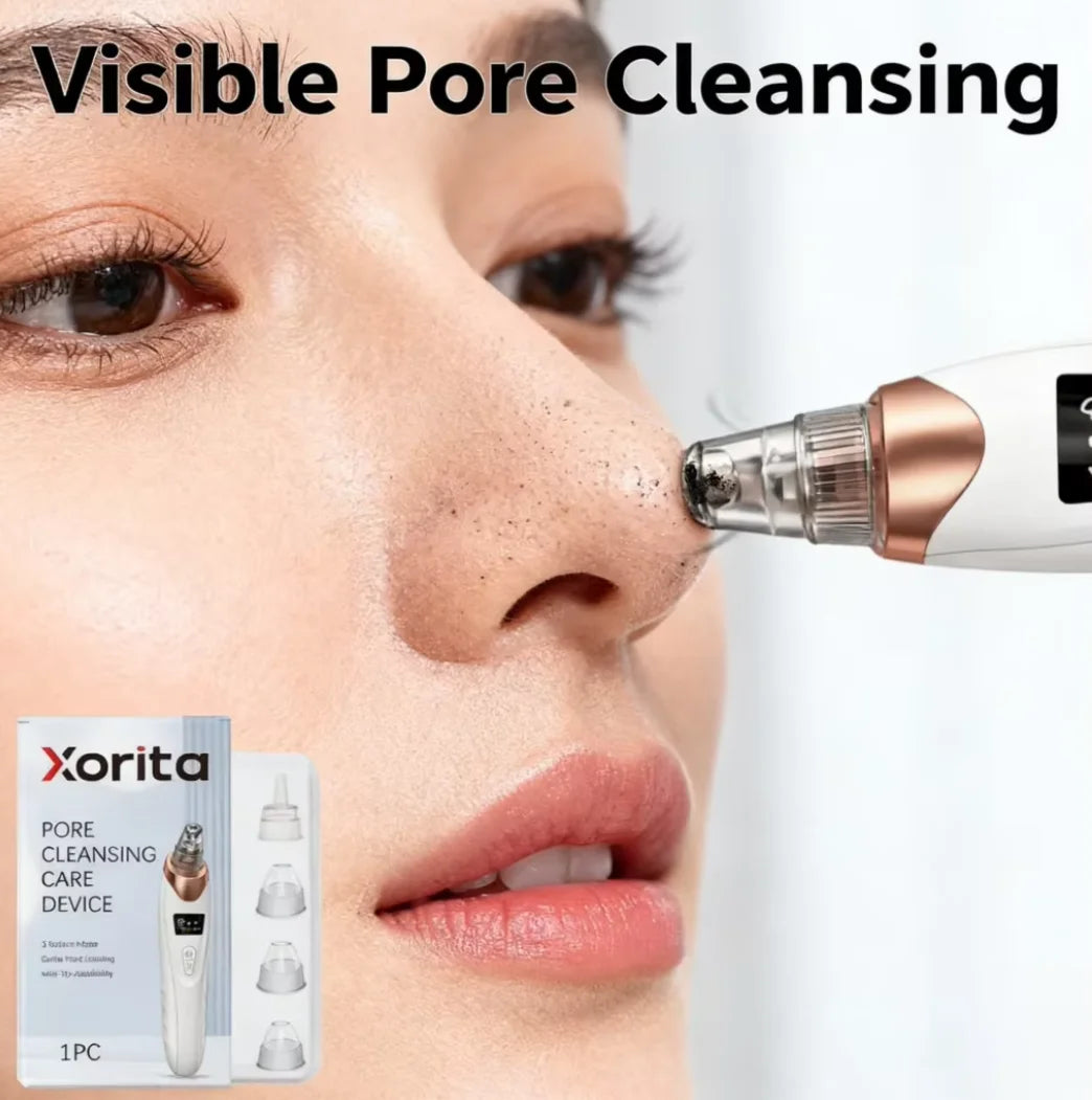 Pore Vacuum Blackhead Remover - 5-Level Suction Facial Cleaner